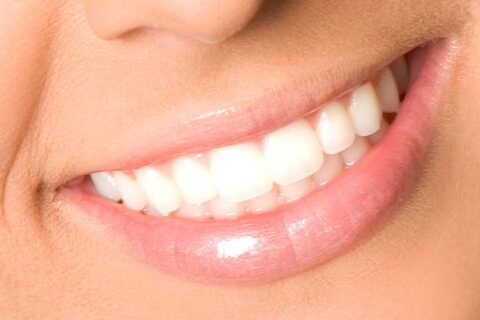 ESTÉTICA DENTAL