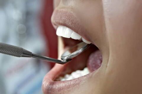 PERIODONCIA